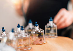 Cupping Clinic In Doha Qatar